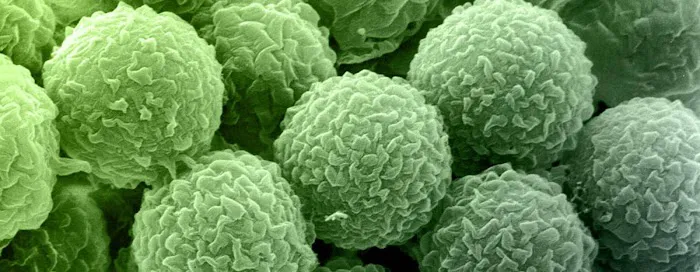 A1 Water & Mold Removal MA Picture 4