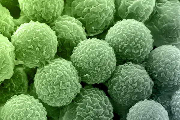 All Restored Picture 6